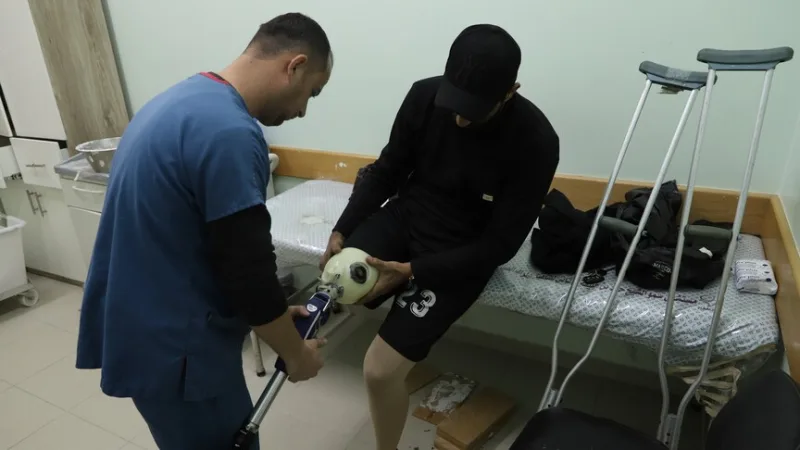 V Gaze, která je pod izraelskou blokádou, čekají Palestinci měsíce, než se jim dostane protézy