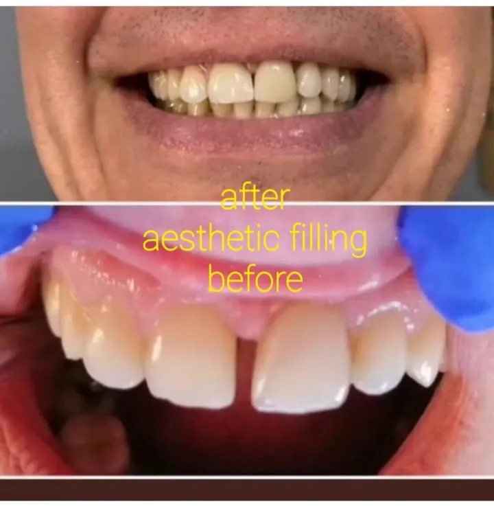 Alanya HEALTHY TEETH Dental Aesthetic — الطب في ألانيا: الطلب عبر الإنترنت والأسعار والتعليقات