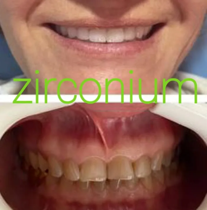 Alanya HEALTHY TEETH Dental Aesthetic — الطب في ألانيا: الطلب عبر الإنترنت والأسعار والتعليقات