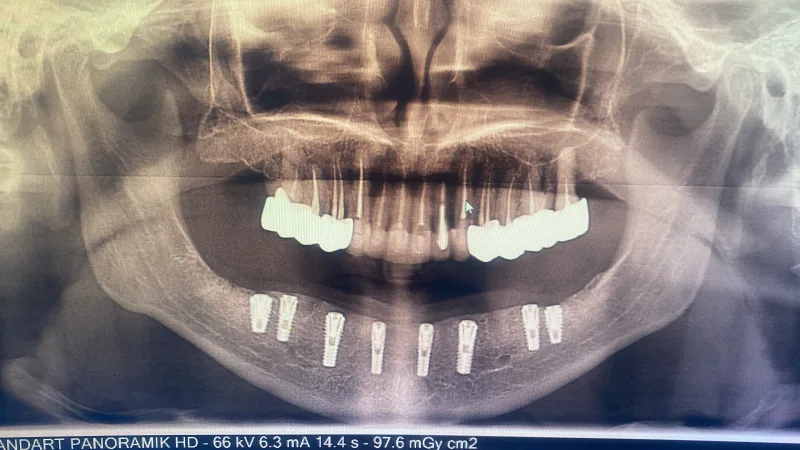 Alanya HEALTHY TEETH Dental Aesthetic — الطب في ألانيا: الطلب عبر الإنترنت والأسعار والتعليقات