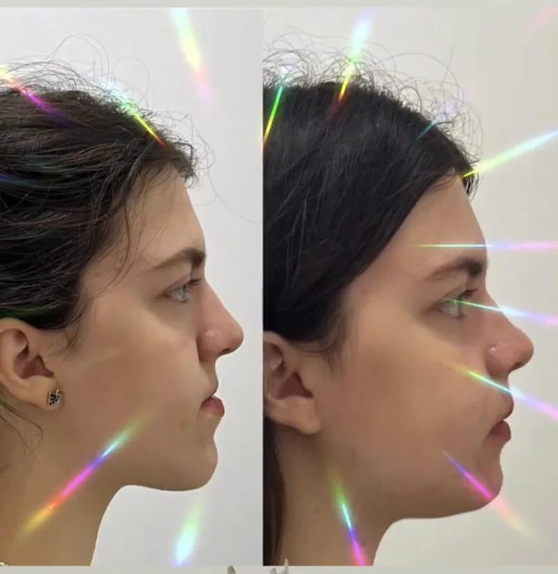 Alanya HEALTHY TEETH Dental Aesthetic — الطب في ألانيا: الطلب عبر الإنترنت والأسعار والتعليقات